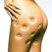 Celulite Tem Cura